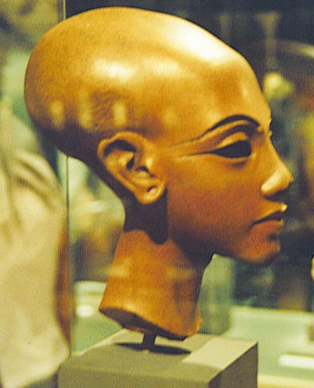 ägyptische Prinzessin mit Schädeldeformation